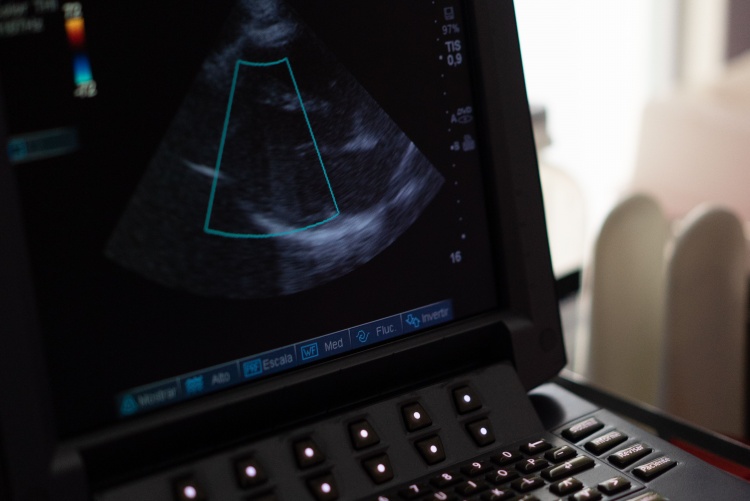 A picture of an ultrasound machine