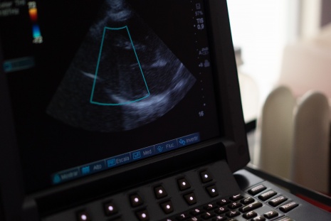 A picture of an ultrasound machine