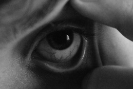 Dry eye