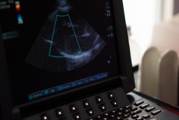 A picture of an ultrasound machine